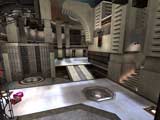 Hipertrofia
